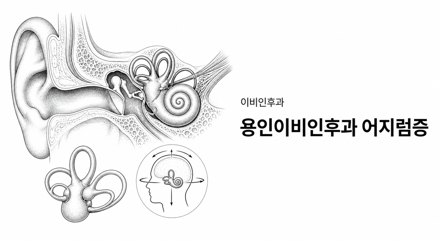 용인이비인후과 어지럼증 핵심 정보 이미지