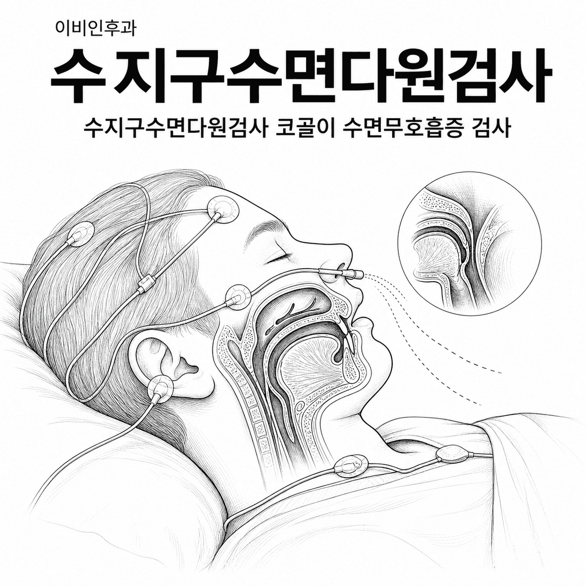 수지구 코골이, 수면다원검사까지 필요할까?